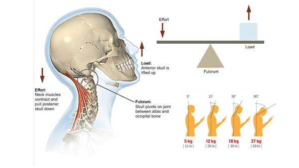 Text Neck